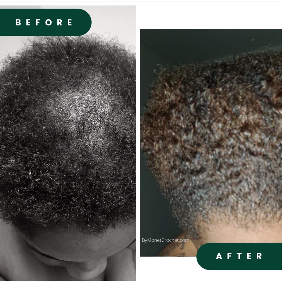 Grow My Edges Back Hair System -