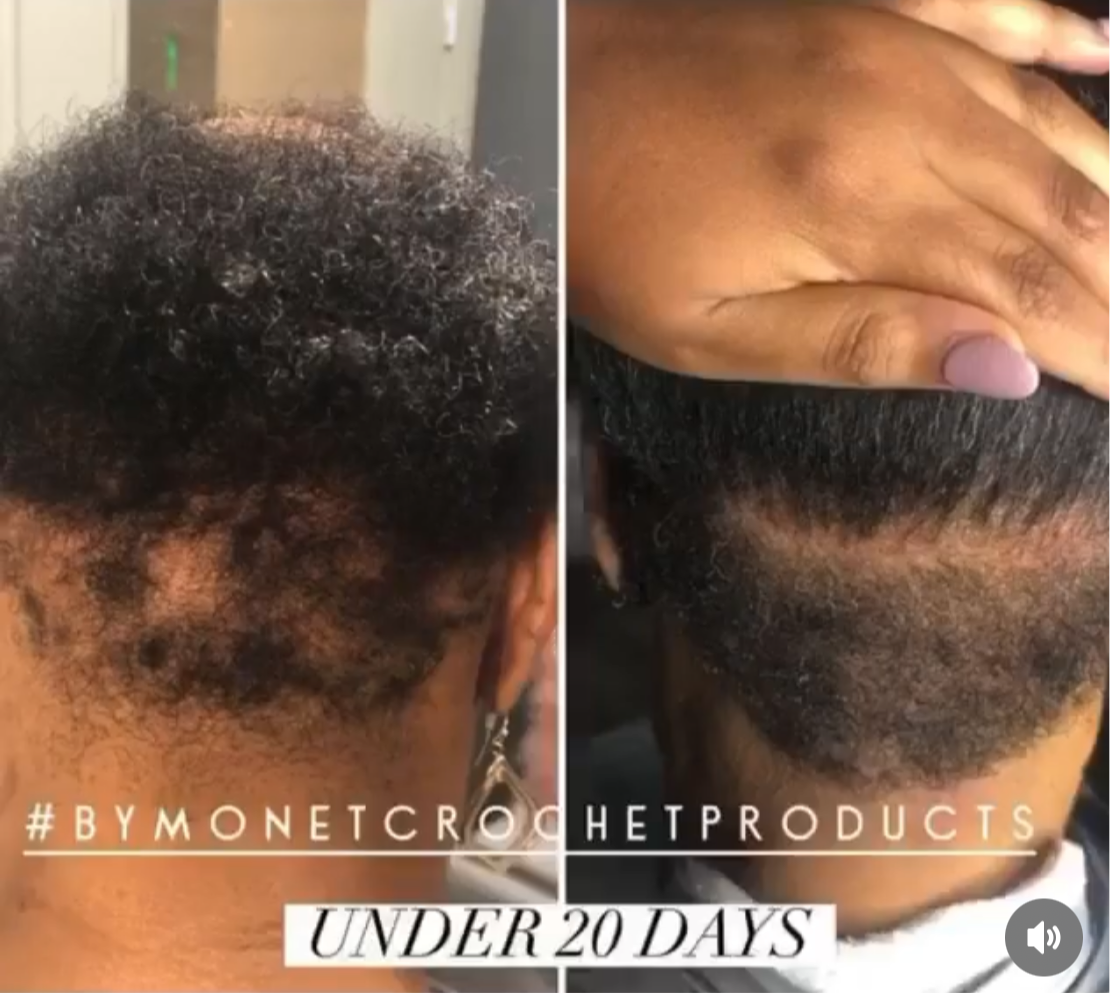 Grow My Edges Back Hair System -