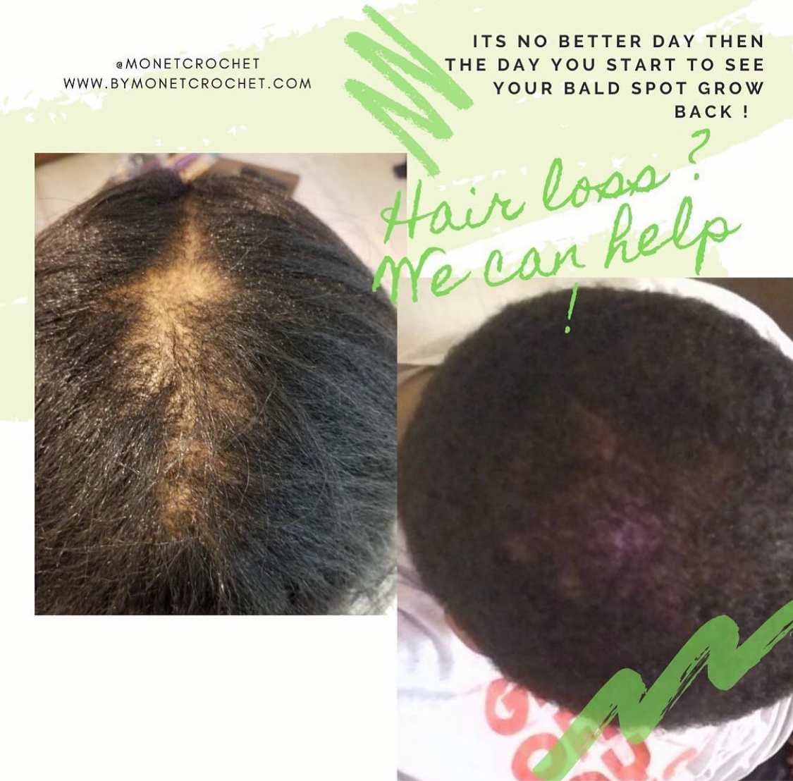 Grow My Edges Back Hair System -